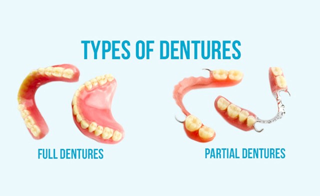 Partial Dentures Before And After San Diego CA 92131